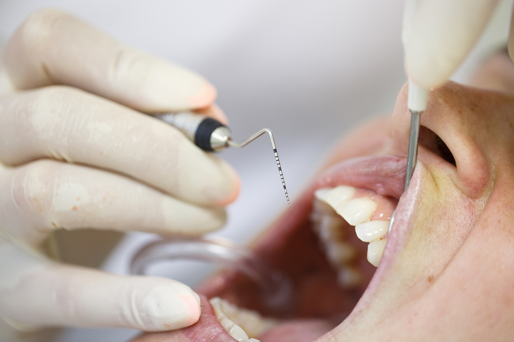 Periodontal Disease – What’s COVID-19 got to do with it?