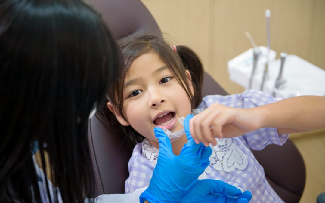 Everything to Know About Spark Aligners Before Your Appointment