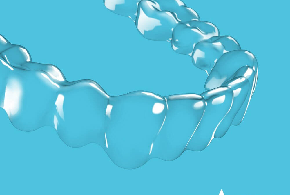 How Your First Spark Aligners Visit Will Go